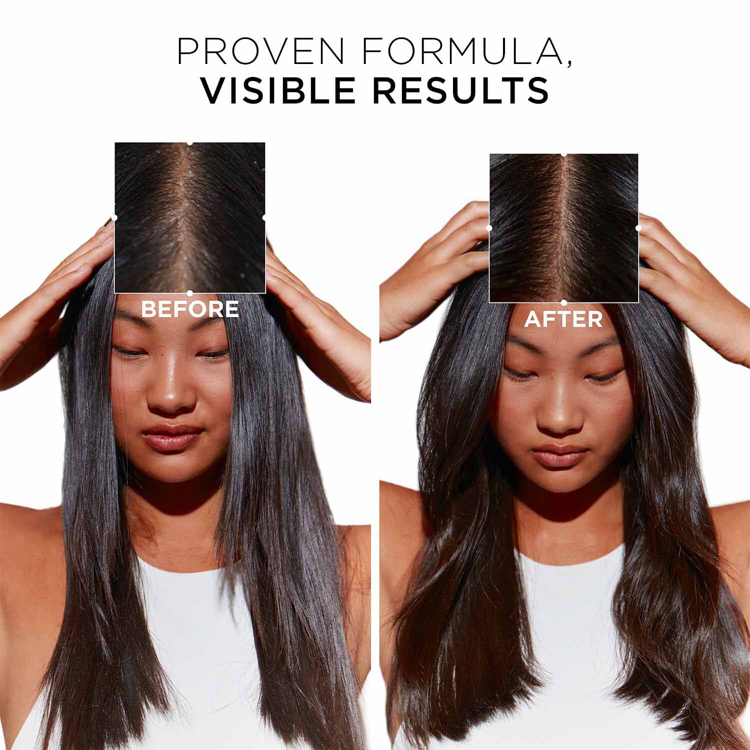 Symbiose Bain Creme Anti-Dandruff Shampoo