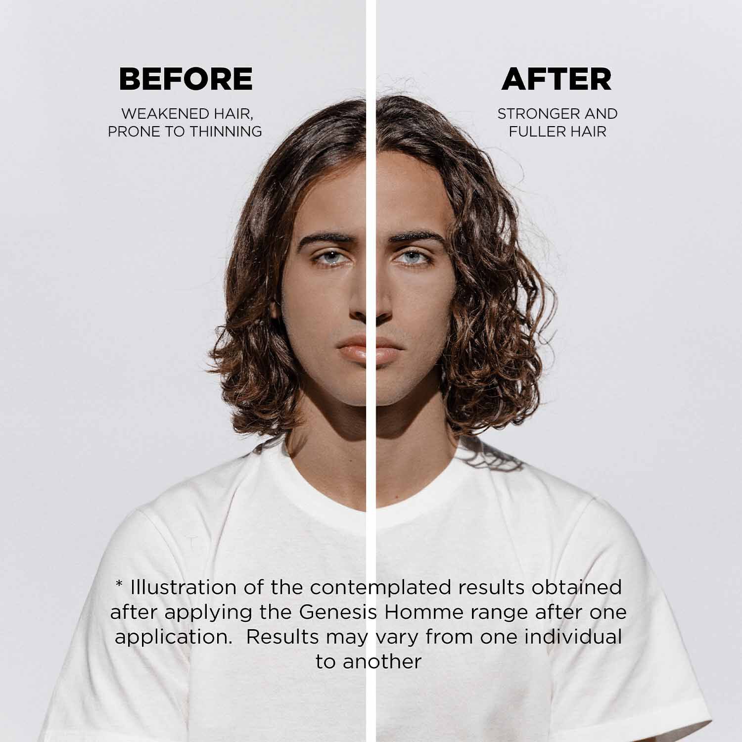 Genesis Homme Anti-Hair Fall Fortifying Serum For Men